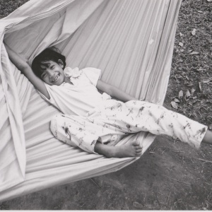 Arm from the Ban Rom Sai Orphanage in Thailand